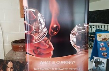 Cupping & Coconut Oil Massage